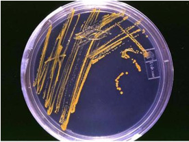 Fig.1 An ager plate streaked with microorganisms. (Wikipedia)